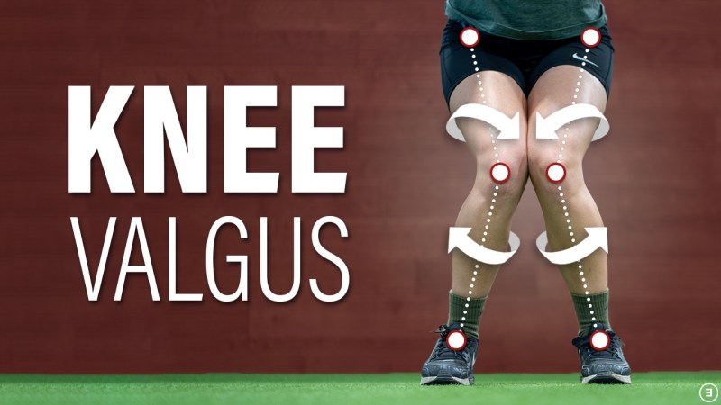 The Truth About Knee Valgus