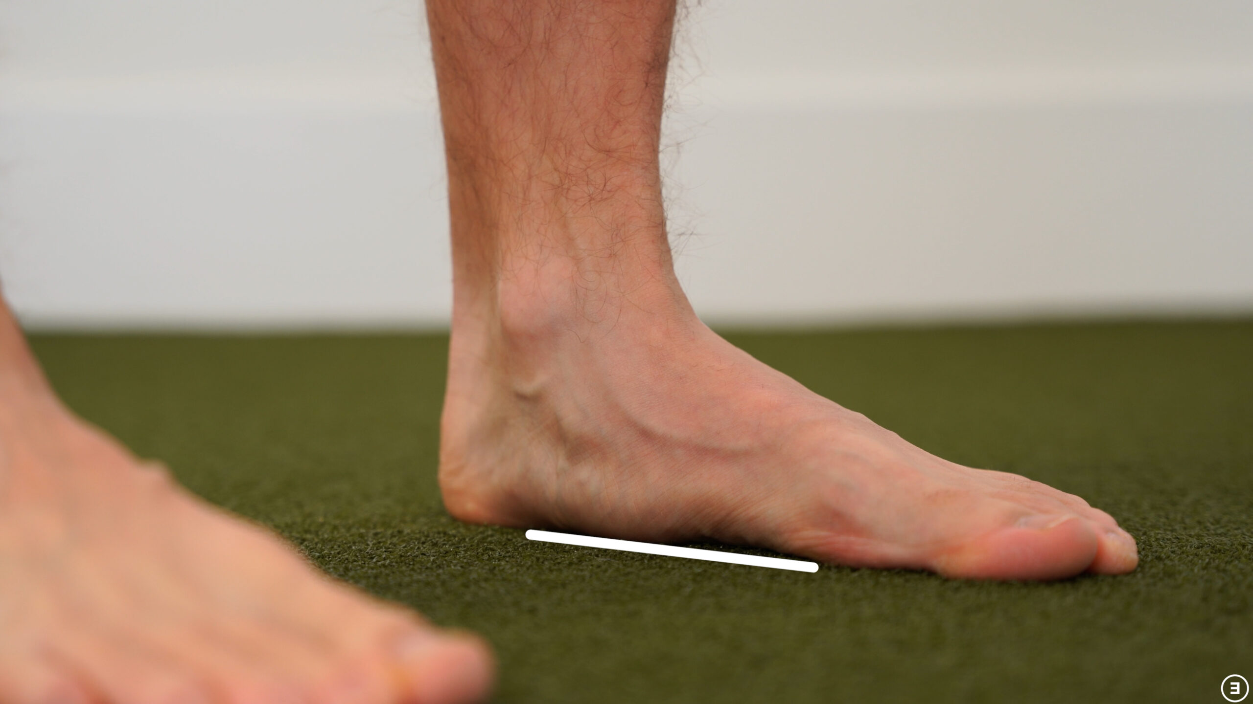 Flat Feet