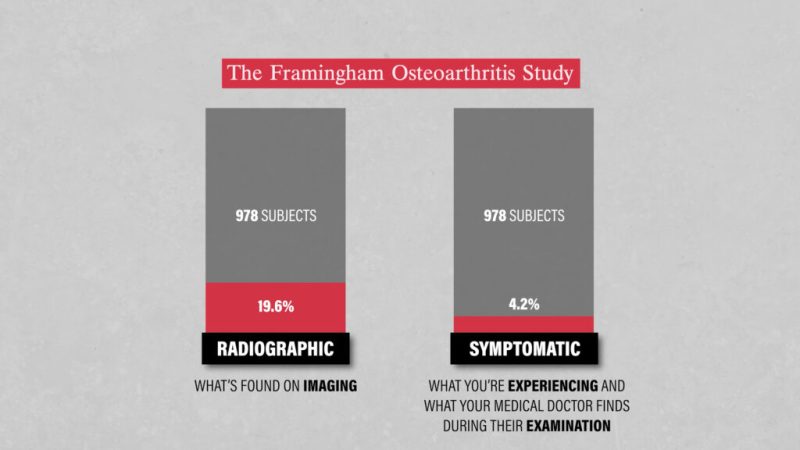 Radiographic vs Symptomatic Hip Osteoarthritis
