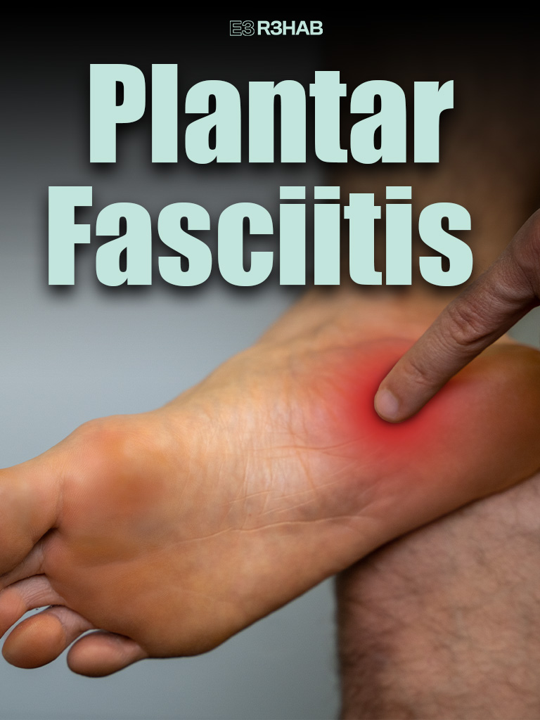 Plantar Fasciiits Program