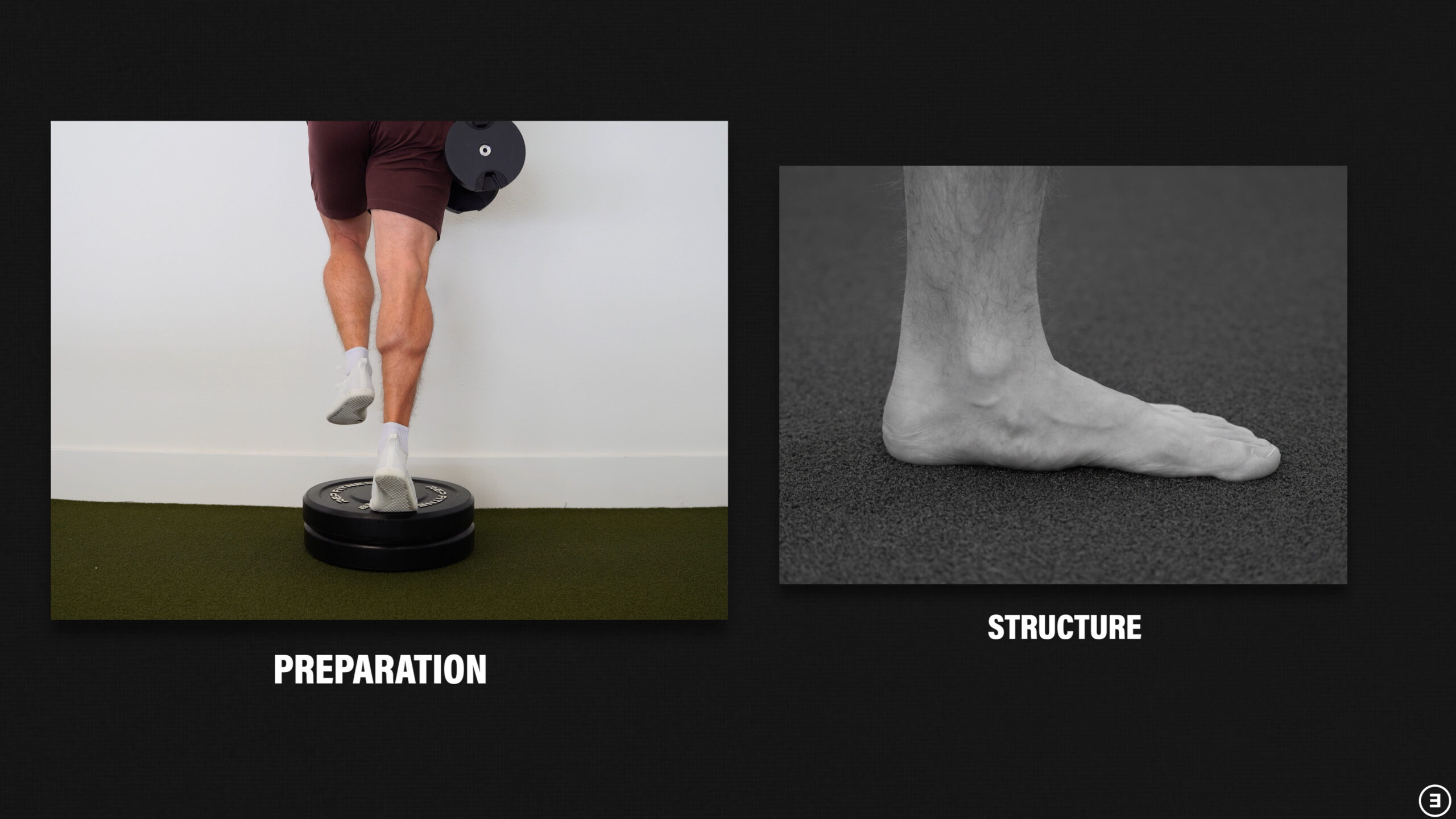 flat feet