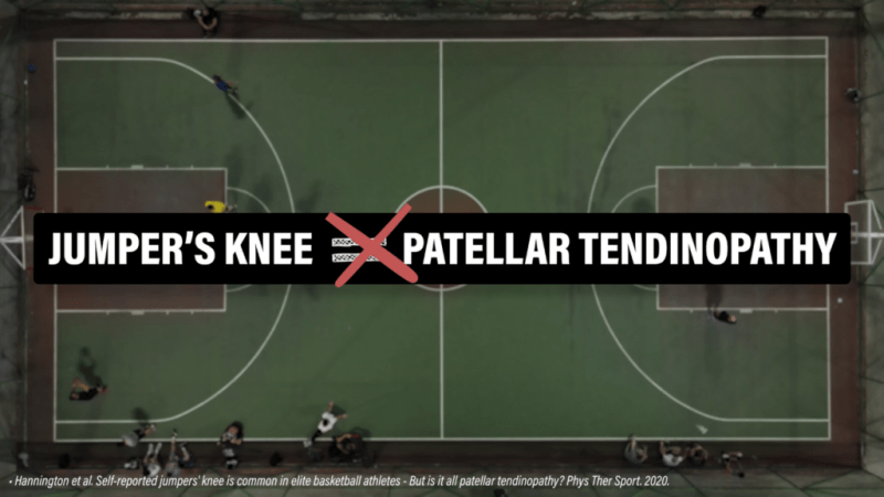 patellar tendinopathy